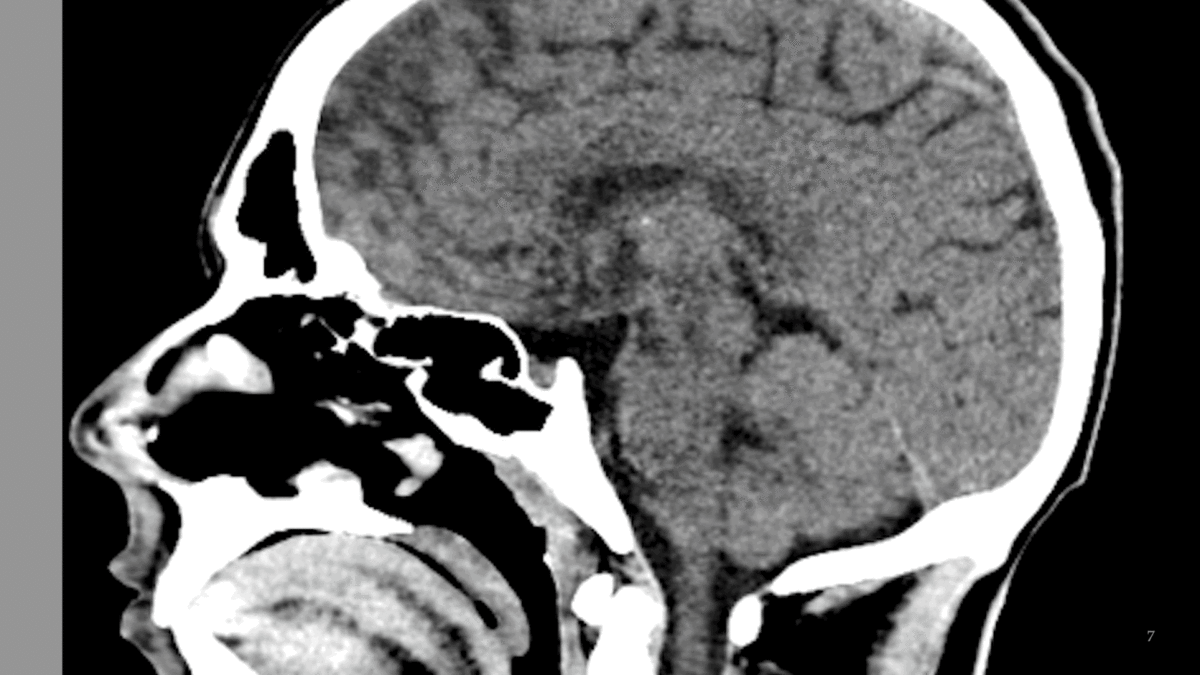 General Imaging Characteristics - Medical Imaging for Undergrads