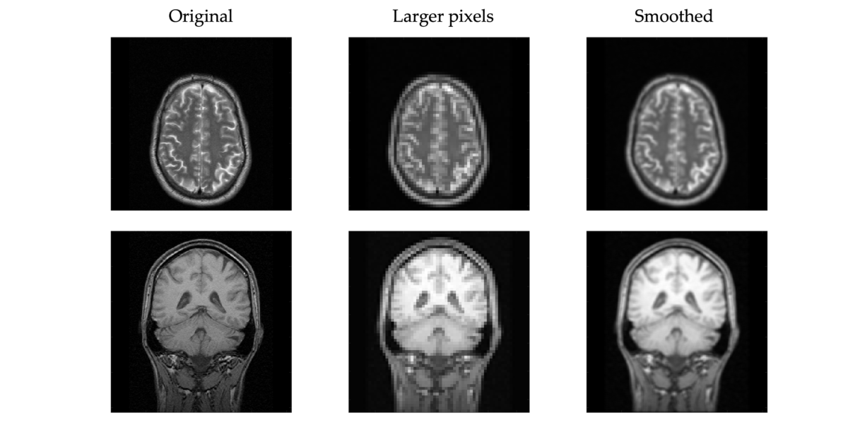 General Imaging Characteristics - Medical Imaging for Undergrads
