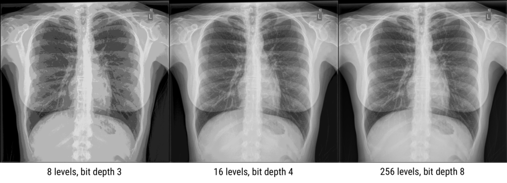 Chest x-rays with different bit depths